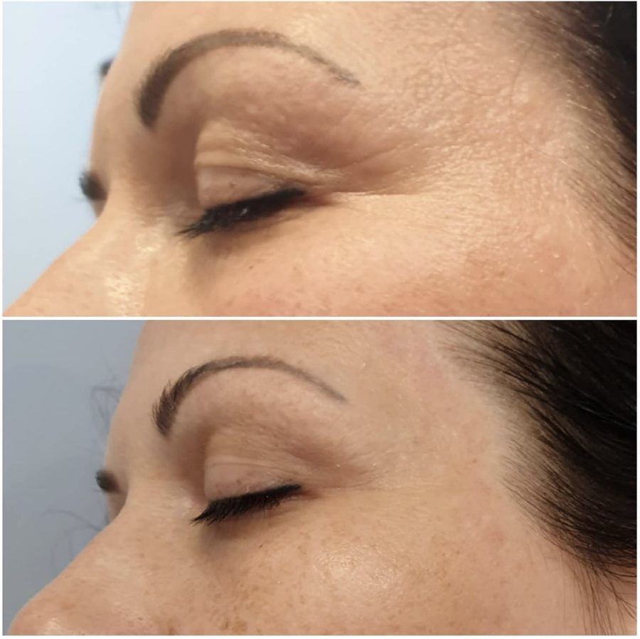 BT Rejuvenation before and after result 17