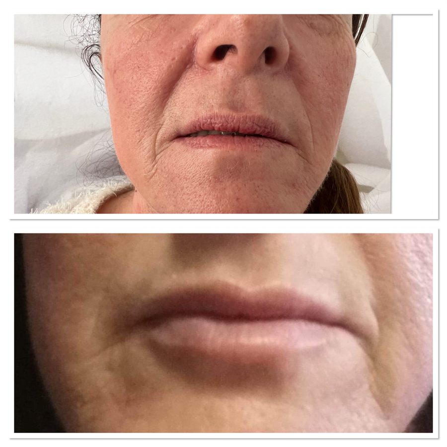 BT Rejuvenation before and after result 20