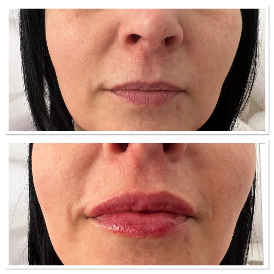 BT Rejuvenation before and after result 24