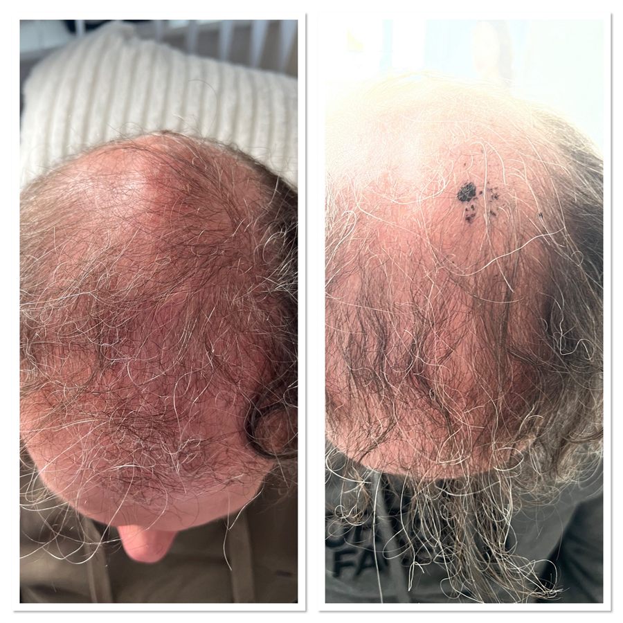 BT Rejuvenation before and after result 28