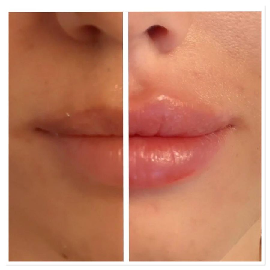 BT Rejuvenation before and after result 33