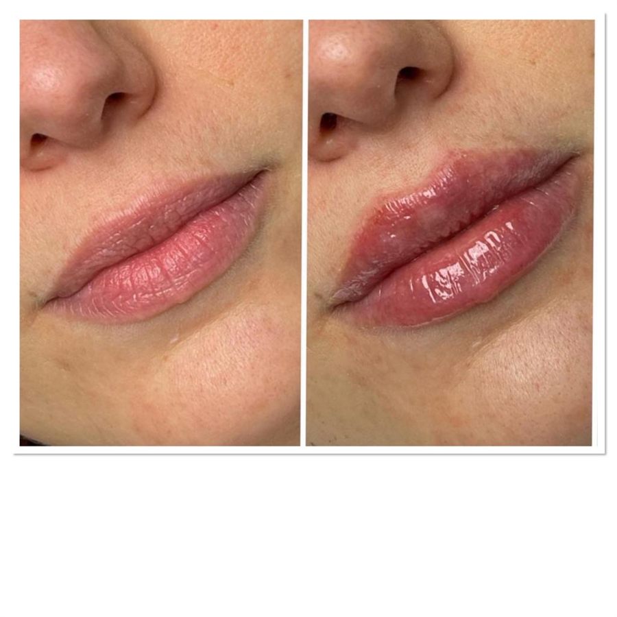 BT Rejuvenation before and after result 35