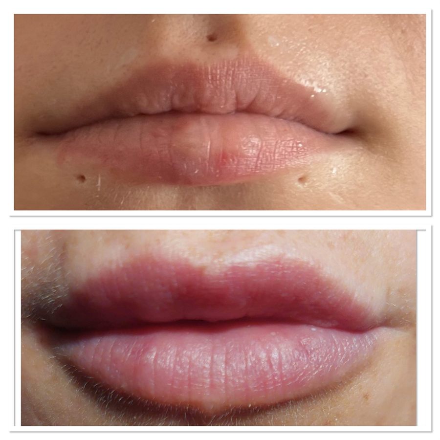 BT Rejuvenation before and after result 38