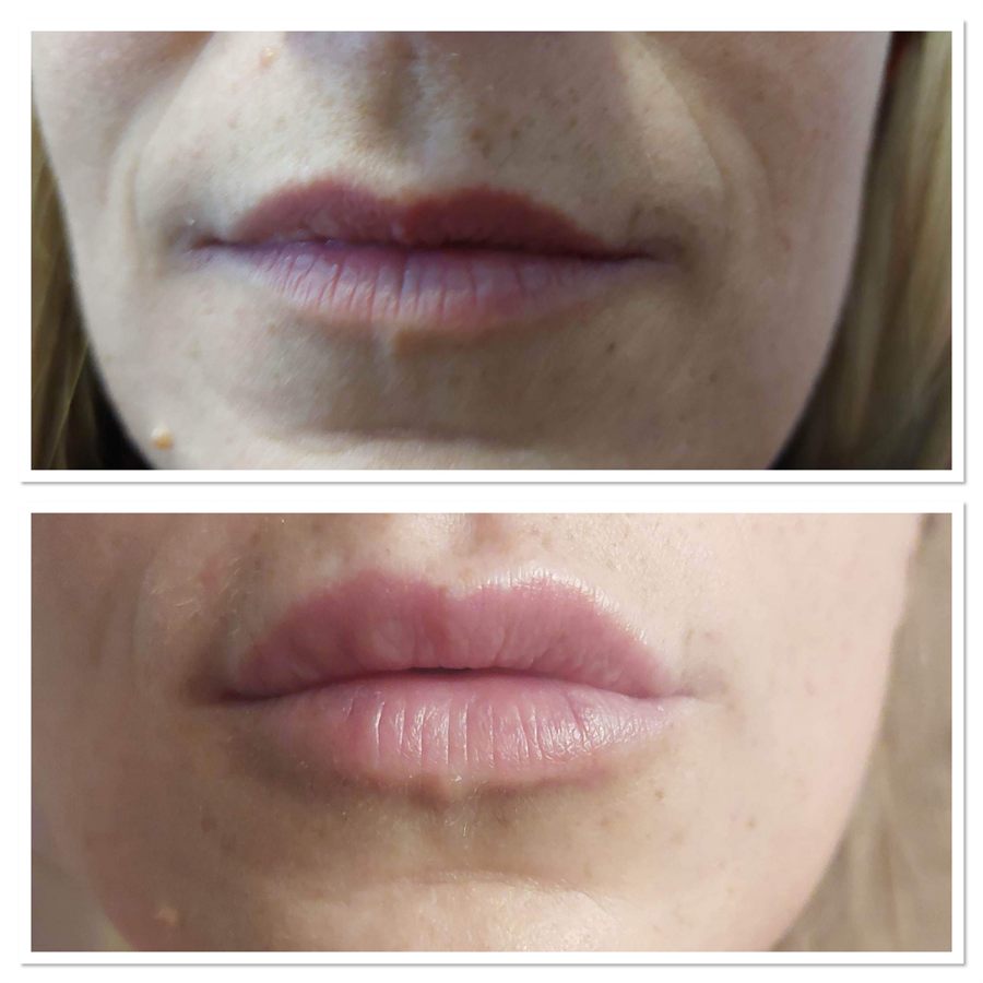 BT Rejuvenation before and after result 42