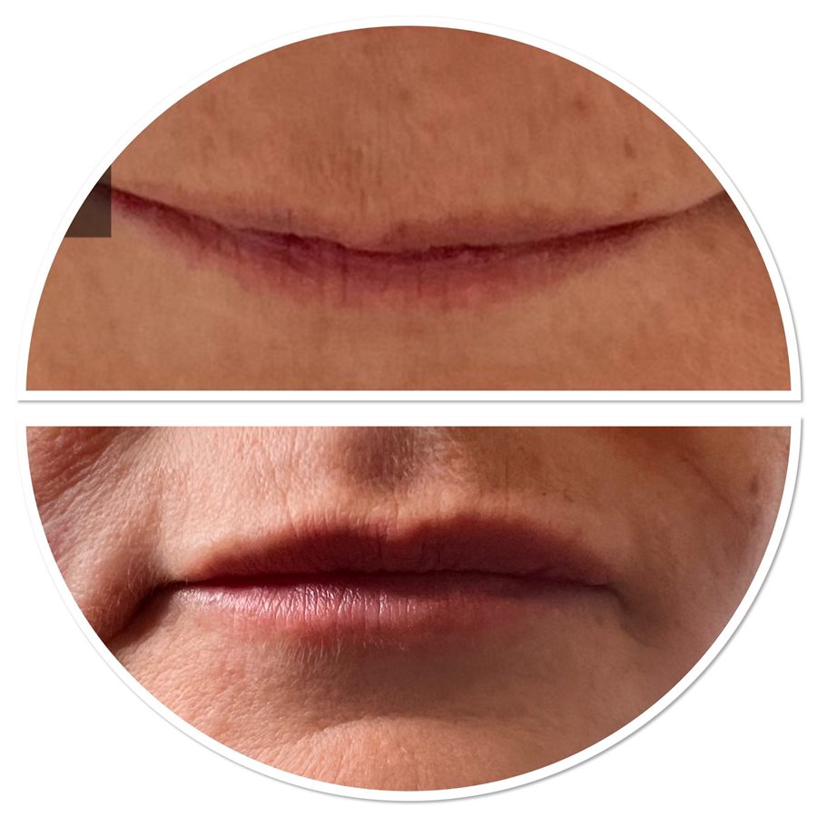 BT Rejuvenation before and after result 61