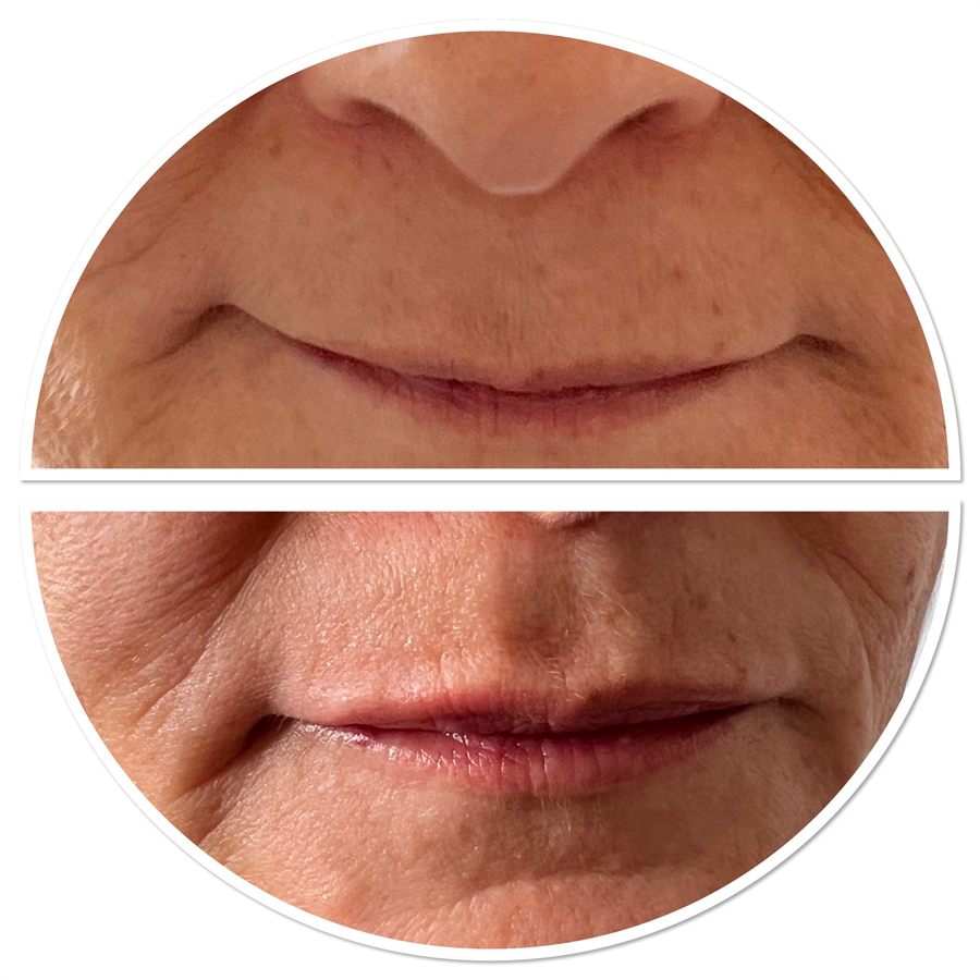 BT Rejuvenation before and after result 73